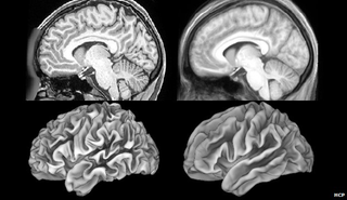 Illustration for article titled Estas son las imágenes más detalladas del cerebro jamás tomadas
